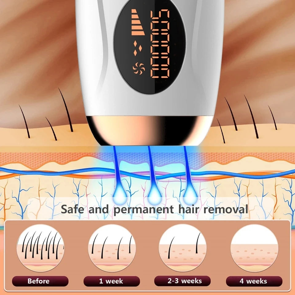 Portable-IPL-Laser-Epilator-999999-Flashes-Painless-Permanent-Hair-Removal-for-Women-s-Body-and-Bikini.jpg